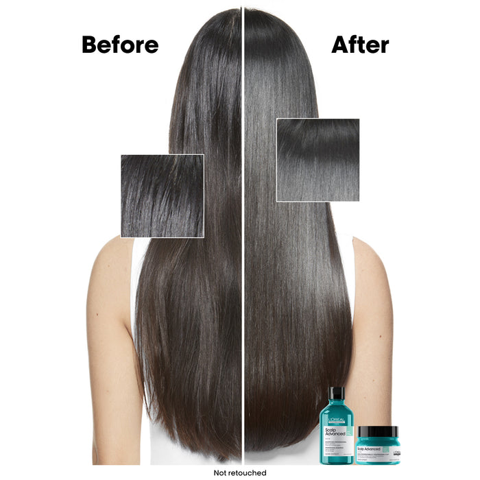 L'Oreal Professionnel Serie Expert Scalp Advanced Anti-Oiliness Dermo-Purifier Shampoo 300ml